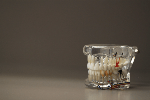 bahan-bahan aktif semprotan sakit gigi